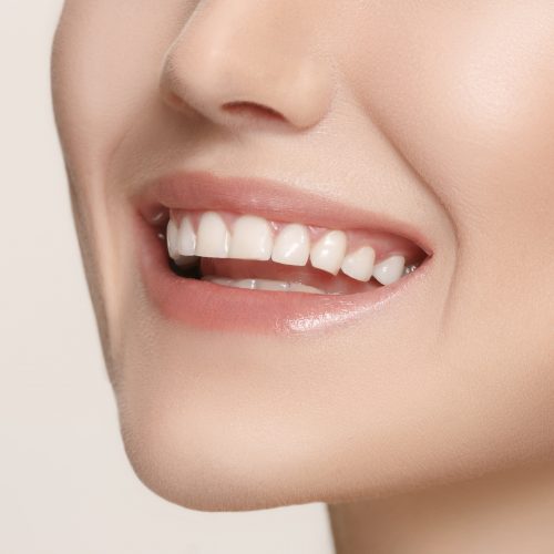 Invisalign North Las Vegas NV